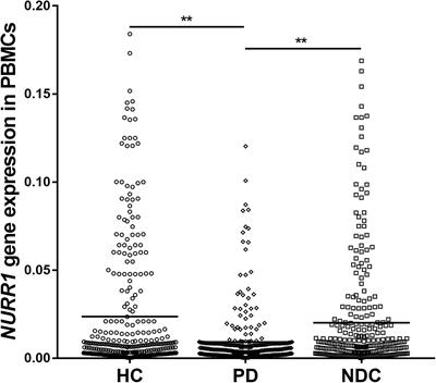 Alterations of NURR1 and Cytokines in the Peripheral Blood Mononuclear Cells: Combined Biomarkers for Parkinson’s Disease